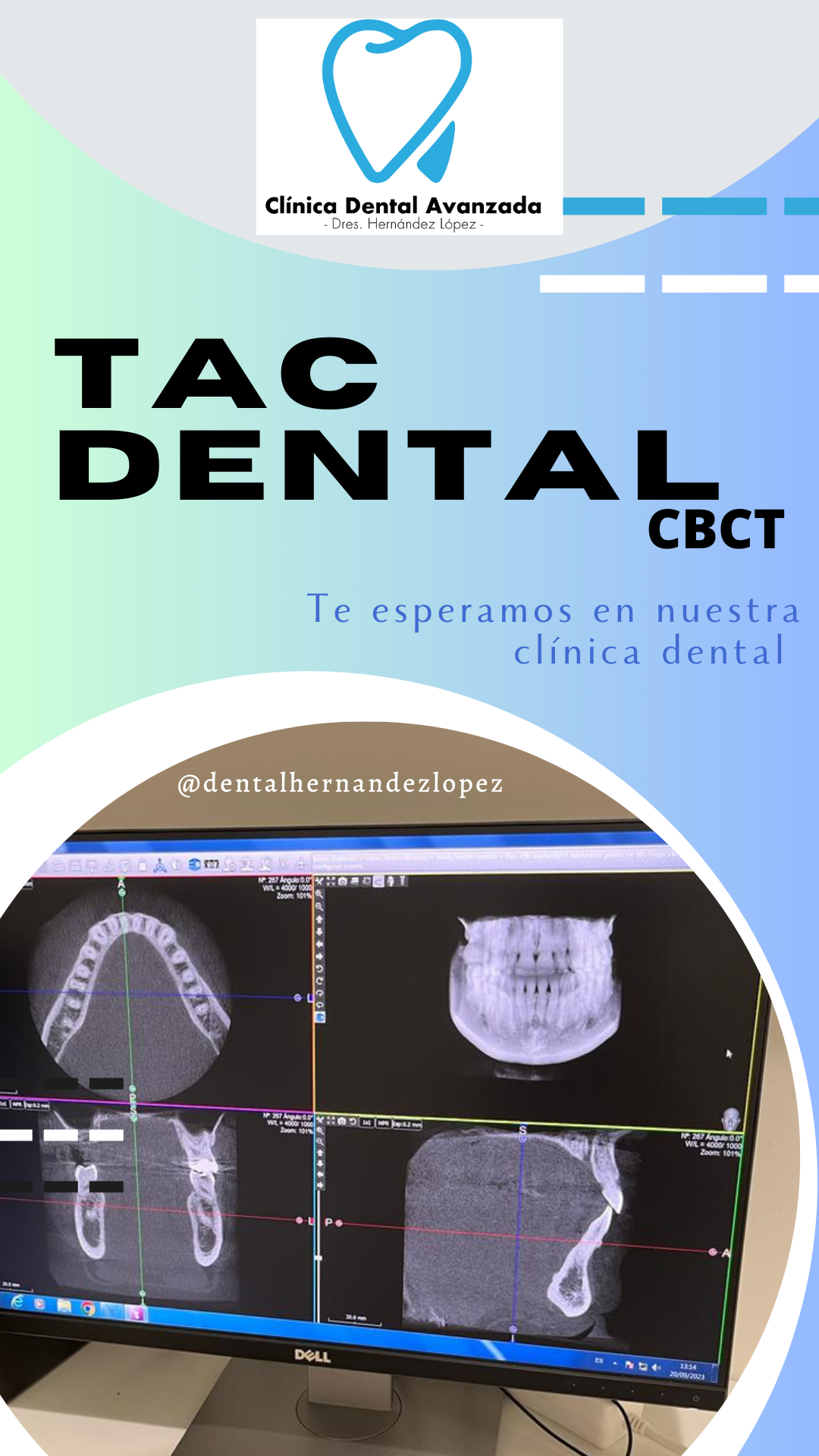 TAC dental CBCT